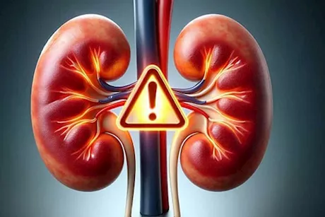 6 نصائح من أجل صيام آمن لمرضى الكلى- طبيب يوضح