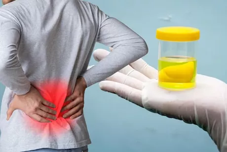 التهابات البول المتكررة- هل تنتقل أثناء العلاقة الحميمة؟ طبيبة تجيب