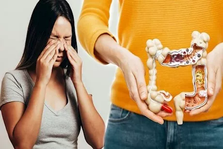 طبيب يوضح الفرق بين مرض كرون وفقر الدم