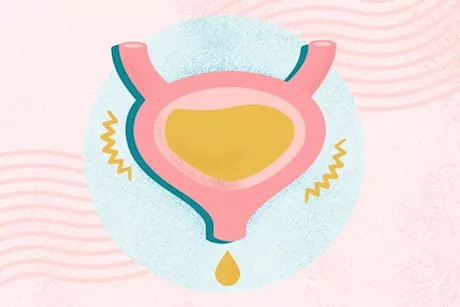 علاج تسرب البول- 9 طرق تستحق التجربة