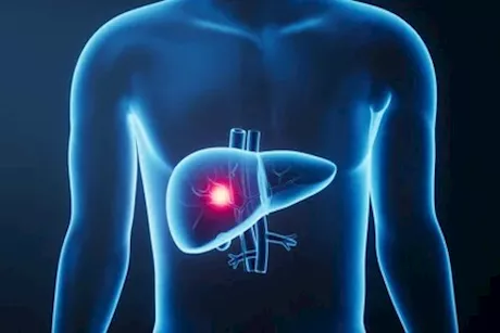 مكان ألم الكبد- أين يحدث في الجسم؟