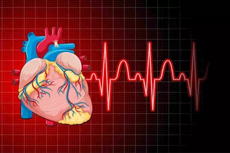 متى تكون سرعة ضربات القلب خطيرة؟- طبيب يجيب "فيديو"
