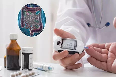 هل يتنبأ ميكروبيوم الأمعاء بمرض السكري قبل سنوات من ظهور الأعراض؟