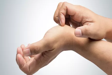 حكة راحة اليد.. هل هي علامة على الإصابة بمرض الكبد؟