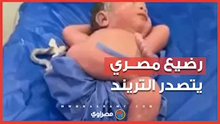 طبيب مصري يوثق وضعية طريفة لرضيع حديث الولادة تحصد ملايين المشاهدات