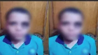 كدمة بعين تلميذ تشعل السوشيال ميديا ومباحث الإسماعيلية تكشف المفاجأة 
