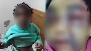 ضبط المتهم بضرب ابنته بعد تداول فيديو لآثار التعذيب في الإسكندرية