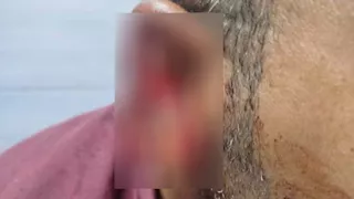 محامي بالمنوفية يكشف كواليس تعرضه لاعتداء وحشي من سيدة: "قفزت على رقبتي وقطعت أذني"