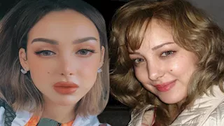 شد الوجه وتجميل الأسنان.. 20 صورة لـ 5 نجمات خضعن لعمليات تجميل