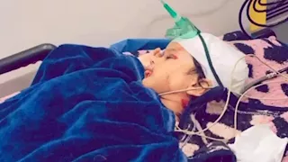تشوهات خطيرة.. مأساة طفل تعرض لهجوم 10 كلاب ضالة برأس سدر (صور)