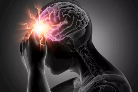 ما الذي يسبب السكتة الدماغية؟- طبيب يجيب "فيديو"