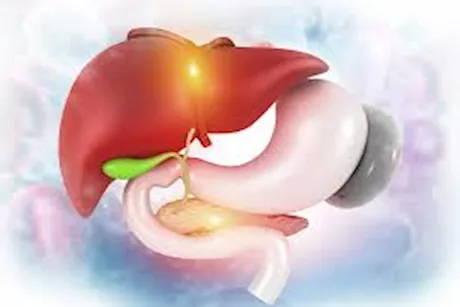 المرارة.. ما هى الزوائد التي تنتج عنها داخل الجسم؟