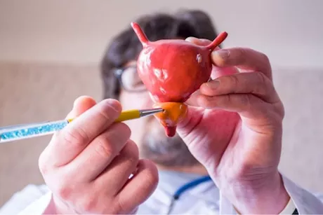 حجم البروستاتا الطبيعي- علامات تدل على تضخمها