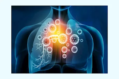 5 أعراض تشير إلى الإصابة بالعدوى الفيروسية في الشتاء