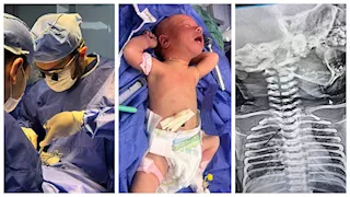 جراحة نادرة.. إنقاذ رضيع عمره أسبوع بمستشفى طلخا المركزي في الدقهلية