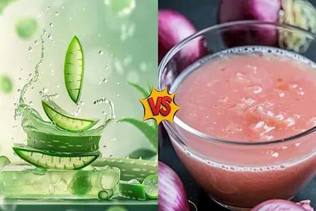 عصير البصل أم الصبار.. أيهما أفضل لعلاج تساقط الشعر.. ؟ 