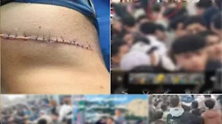 لهو التلاميذ ينتهي بطعنة.. تفاصيل اعتداء طالبين على زميلهما بالمنوفية