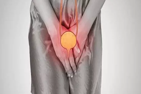 تكرار التهاب المسالك البولية عند النساء- أسبابها ونصائح للتخلص منها