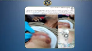 خلاف على لهو الأطفال ينتهي بتعدٍ بسلاح أبيض بالدقهلية