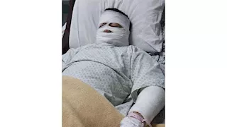 نازل يجيب سحور شوهه زيت مغلي.. "مازن" ضحية تهور قائد موتوسيكل ببنها