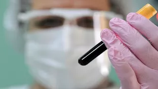 تصيب الجهاز التنفسي للبشر.. مخاوف من جائحة جديدة بعد رصد "إنفلونزا D" 