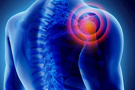 ما هو العضو الذي يمكن أن يسبب ألمًا في الكتف الأيمن؟- طبيب يجيب