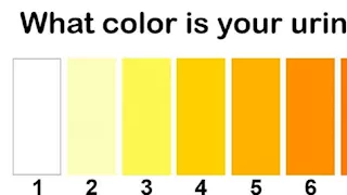 لون البول.. ما الذي يمكن أن يكشفه عن صحتك؟