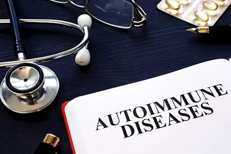  أمراض المناعة الوراثية- طبيبة تجيب: هل يمكن الوقاية منها؟ "فيديو"