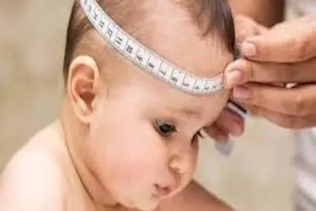 4 طرق لتشخيص ضخامة رأس الطفل بعد الولادة- طبيب يوضح