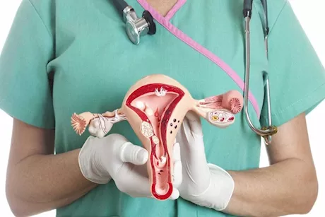 أعراض الأورام الليفية.. استخدم هذه الطريقة للتخلص منها