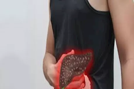 مع اقتراب رمضان.. طبيب يحدد إرشادات لمريض الكبد للصيام بأمان