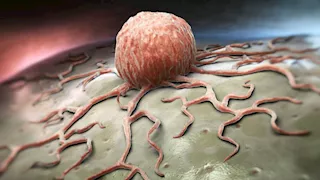 تناولها في رمضان.. 7 أطعمة تحارب السرطان وتقوي المناعة