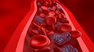 5 أطعمة تساعد في تنظيم ضغط الدم وتحمي من الجلطات.. قنبلة فوائد