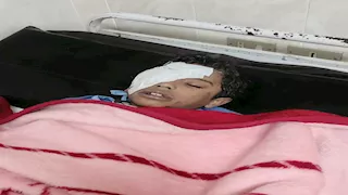 "واحد كتفه والتاني ضربه بالقلم".. أسرة تلميذ تتهم زميليه بتصفية عينه داخل الفصل