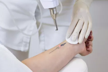 ما هي أضرار التاتو؟