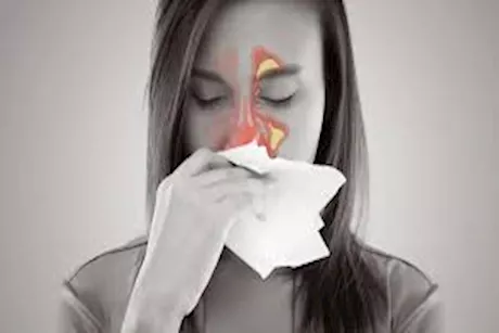 الجيوب الأنفية.. متى تكون مشاكلها خطيرة؟