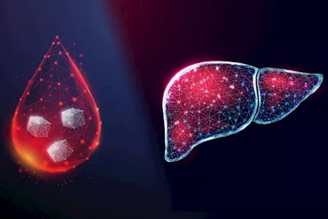 الكبد والسكر- تعرف على العلاقة التي تربط الاثنين ببعضهما البعض