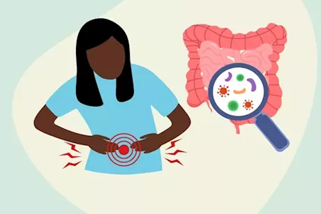 أعراض تسمم الفسيخ- إليك موعد ظهورها بعد الإصابة وأبرز طرق علاجها