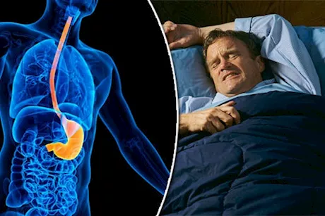 الحموضة ليلا- طبيب يوضح أسباب حرقة المعدة في الليل وعلاجها