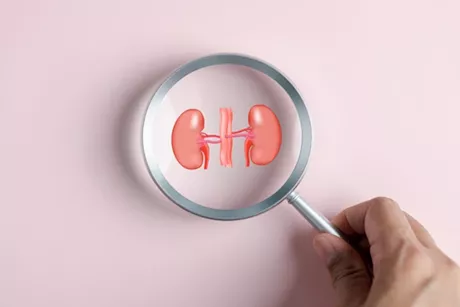 مدة علاج الكلى- طبيب يوضح أبرز علامات الشفاء من الفشل الكلوي