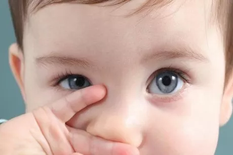 المياه البيضاء على عيون الأطفال.. إليك الأسباب