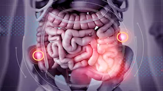  هل شعرت بهذه الأعراض في معدتك؟ 7 علامات تكشف جرثومة المعدة