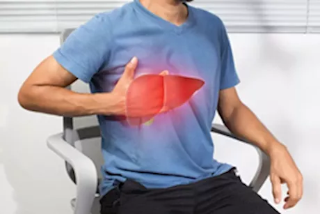 هل التثدي عند الرجال علامة على الإصابة بـ الكبد الدهني؟