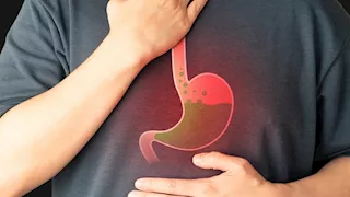 خطر السحور الدسم.. لماذا تزداد نوبات ارتجاع المريء في شهر الصيام؟