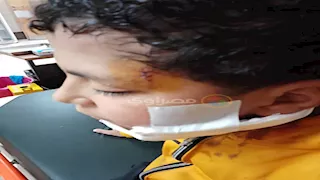 مأساة صلاة التراويح.. "طفل الخانكة" يشوه وجه آخر بكتر داخل مسجد بالقلج (صور) 