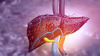  كيف تحسن أداء الكبد بطريقة طبيعية وسهلة؟