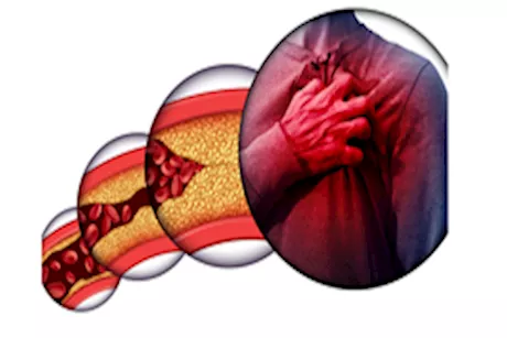 لو بتعانى من ارتفاع الكوليسترول.. مشروبات قد تزيد حالتك سوء