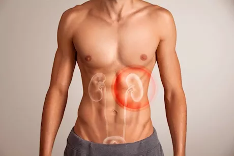 تلف الكلى عند الرجال- 10 أعراض تكشف إصابتك احذر تجاهلها