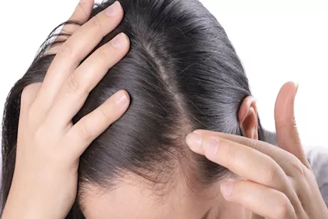 مكملات وفيتامينات قبل الولادة.. هل تعزز نمو الشعر وما البدائل الآمنة؟