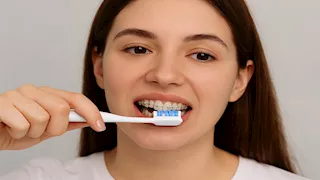 خطأ في تنظيف الأسنان يؤدي إلى تآكل اللثة.. إليك الطريقة الصحيحة